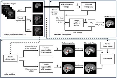 A Probabilistic Atlas of the Pineal Gland in the Standard Space